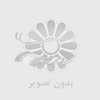 کاشت ایمپلنت دیجیتال دندان در شیراز